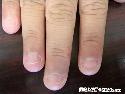 剪指甲、挖耳屎，这些日常小动作竟隐藏大危害！ - 石河子生活资讯 - 石河子28生活网 shz.28life.net